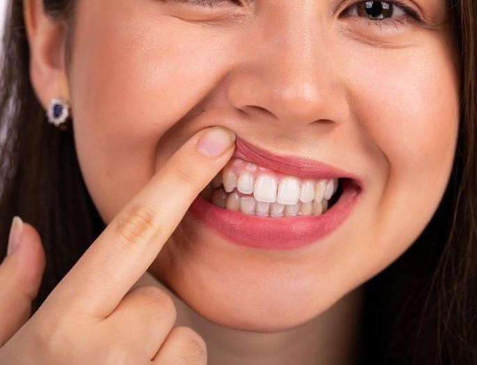 Cosmetic Dental Insurance for Veneers, Whitening, and Crowns