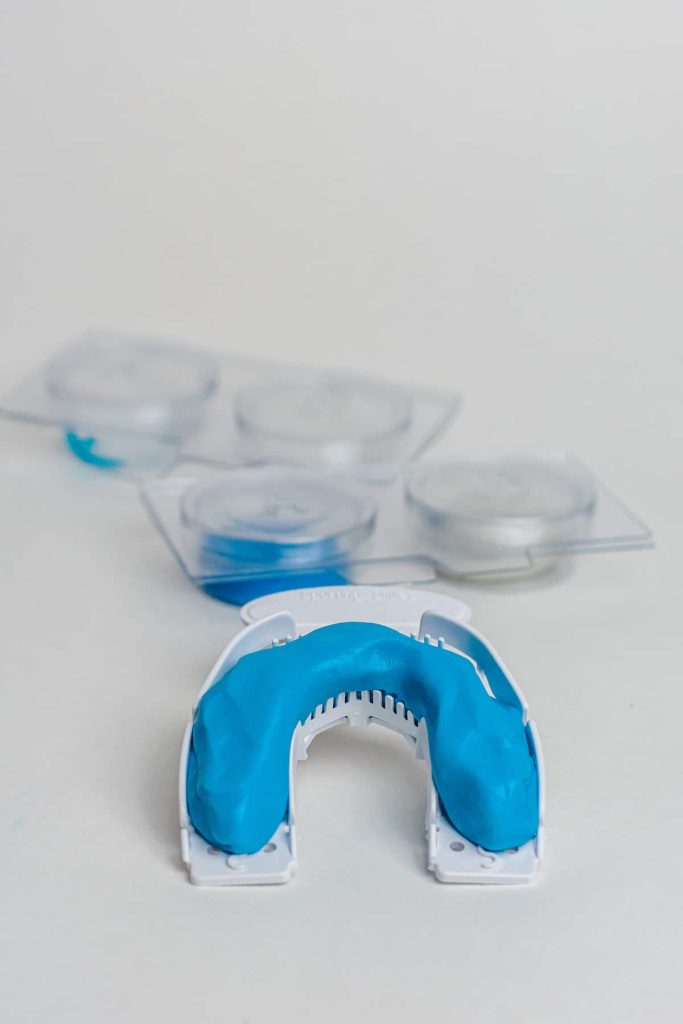 Retainer Replacement Do You Need It and What's the Cost?