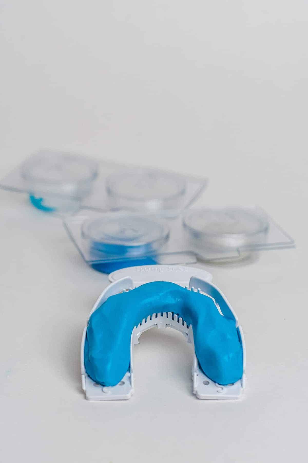 Retainer Replacement Do You Need It and What's the Cost?