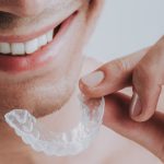 74497Best Soft Night Guards for Teeth Grinding, Clenching, and TMJ