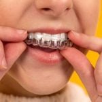 77849Invisalign Braces Guide: Types, Brands, Cost, and More!