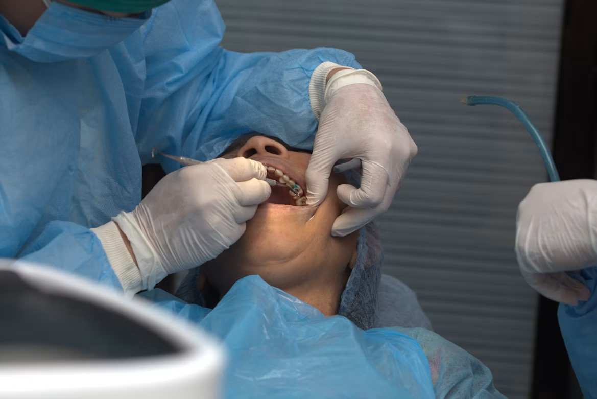 Dental team performing a full-arch implant procedure