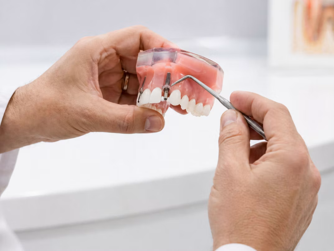 Hands holding a dental implant model with a dental probe