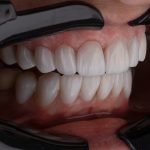 83333Emergency Dentist in Long Beach, California: Find a Dentist Available Now