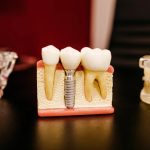 83336Emergency Dentist in Long Beach, California: Find a Dentist Available Now