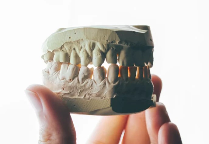 Dental model of teeth held in a hand