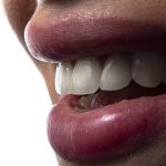 83345Dental Implant Loans: Learn How to Finance Your Implants by Borrowing