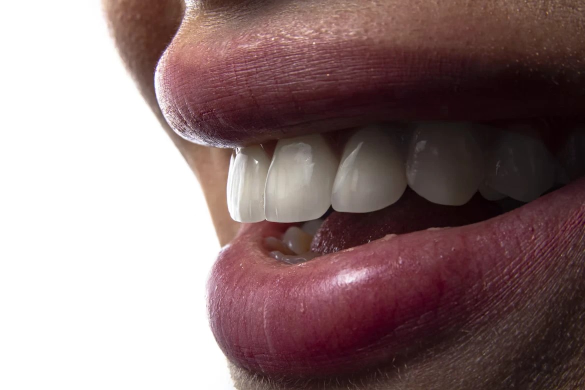 Close-up of a healthy smile showing front teeth
