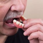83348Dental Implant Loans: Learn How to Finance Your Implants by Borrowing