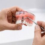 83351Dental Implant Loans: Learn How to Finance Your Implants by Borrowing