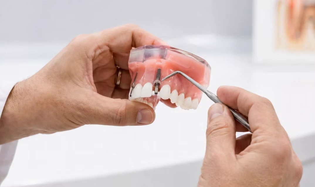 Dentist pointing at a dental implant model