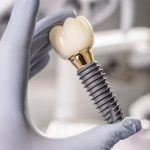 83376How to Evaluate Dental Implant Ads Before Booking a Consultation