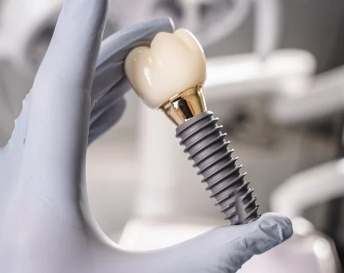 Dental implant with crown held in a gloved hand