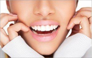 sourire avec facettes