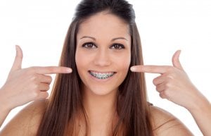 pourquoi poser des cales en orthodontie ?