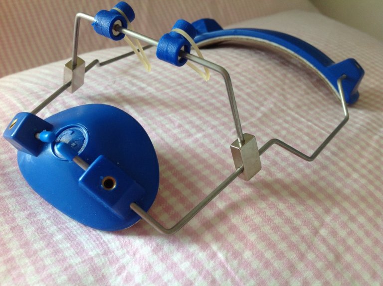 Appareil dentaire enfant et quad helix guide sur l