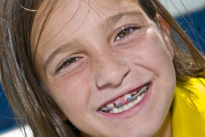 Orthodontie précoe