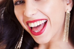 sourire après traitement à base d'appareil dentaire invisible