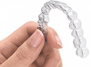 Points forts Invisalign