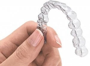 gouttière invisalign