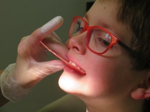 Enfants appareil dentaire