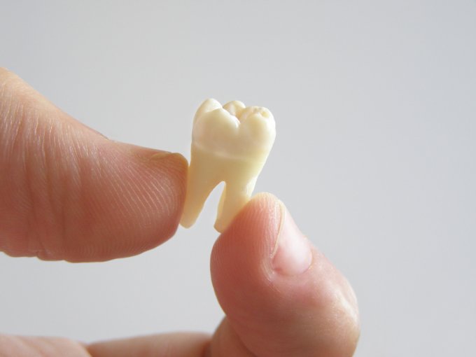 Arracher une dent les secrets de l