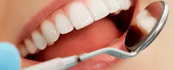 Gros plan d'une bouche d'adulte avec des dents parfaitement alignées et un miroir buccal