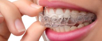 Gros plan sur une gouttière transparente Invisalign