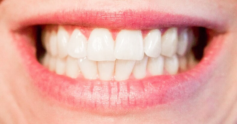 Les dents jaunes