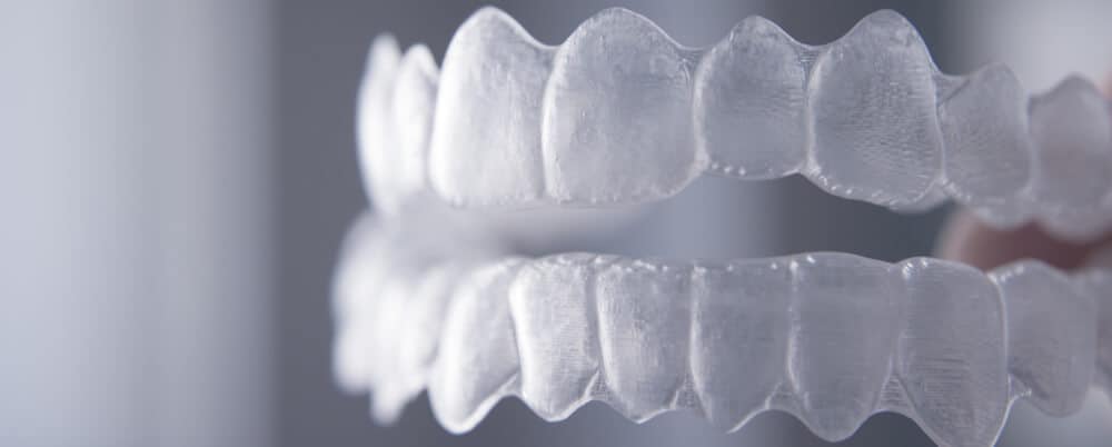 Invisalign