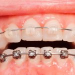 40972Névralgie faciale dentaire : symptômes, causes et traitements