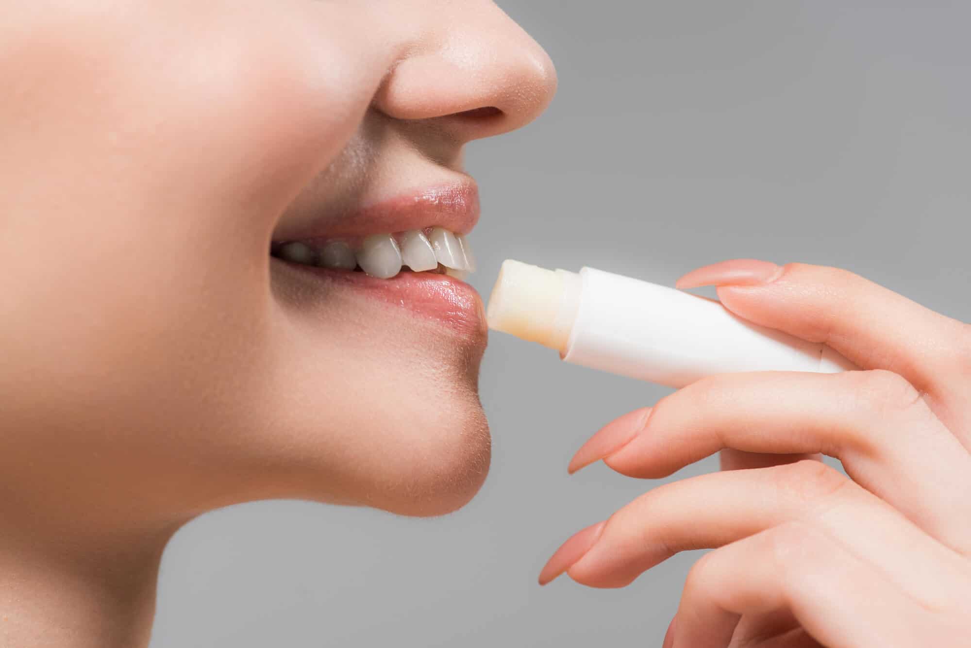 La perleche : diagnostic et traitements - Dentaly.org