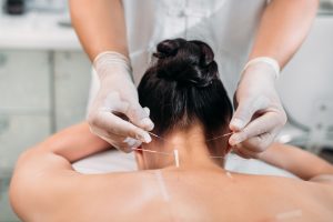lichen plan medecine chinoise