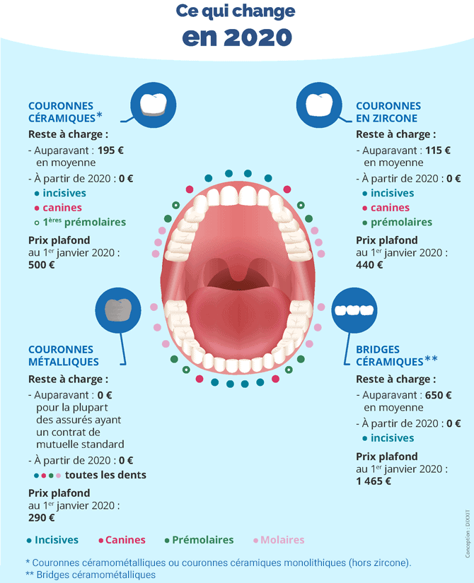 Remboursement 100% santé dentaire