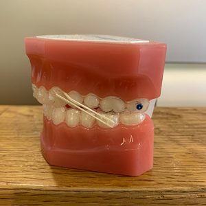 élastiques orthodontiques