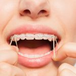 40017L’orthodontie précoce : notre interview de Dr Zarrinpour