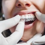 22297Névralgie dentaire : symptômes, causes et traitements