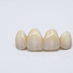 22953Mutuelle qui rembourse l’orthodontie adulte : comment choisir ?