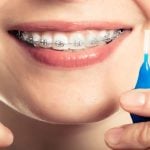 23708Carie dentaire : les causes, symptômes et traitements courants